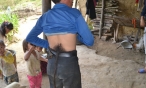 Chuyện lạ Việt Nam: Người đàn ông mọc đuôi dài gần 1 mét, hễ cắt đi là ốm thập tử nhất sinh