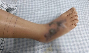Phú Thọ: Liên tiếp ghi nhận trường hợp rắn hổ mang 'núp' trong nhà tấn công con người
