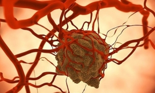 Các nhà khoa học tìm ra phương pháp tiêu diệt tế bào ung thư bằng cơ chế tự hủy