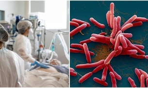 Người phụ nữ tử vong chỉ vài giờ sau khi nhập viện do nhiễm 'vi khuẩn ăn thịt người'