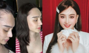 Lâm Khánh Chi khiến netizen sửng sốt với ảnh mặt mộc, tóc thưa sau khi chi tiền tỷ để trẻ lại 20 tuổi