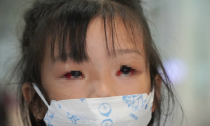 Chỉ trong 3 ngày có gần 6.500 học sinh một huyện ở Đà Nẵng bị đau mắt đỏ