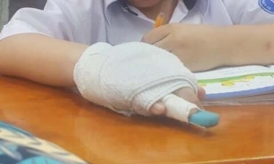 Cô giáo đánh gãy ngón tay học sinh lớp 1 bị kỷ luật cảnh cáo
