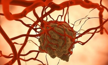 Các nhà khoa học tìm ra phương pháp tiêu diệt tế bào ung thư bằng cơ chế tự hủy