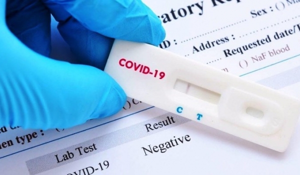 Bộ Y tế đề nghị đưa kit test COVID-19 vào diện hàng bình ổn giá