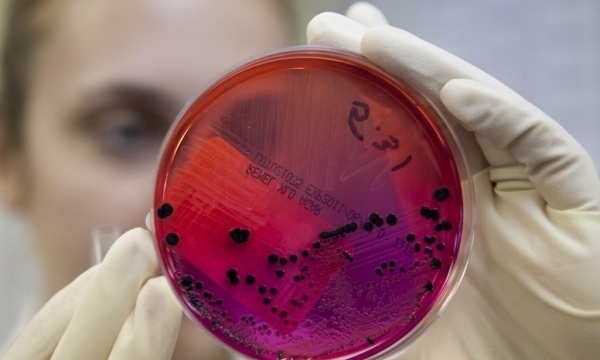 Chứng nhận huyết thanh khuẩn Salmonella mới để kiểm soát dịch bệnh