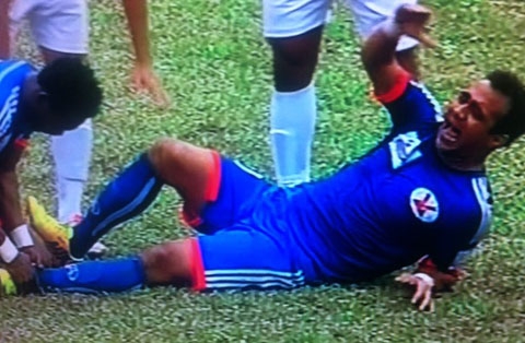 Cầu thủ Than Quảng Ninh gãy gập chân vì vào bóng quá mạnh                                                   Hoa hậu giúp sao Everton hồi phục thần kỳ