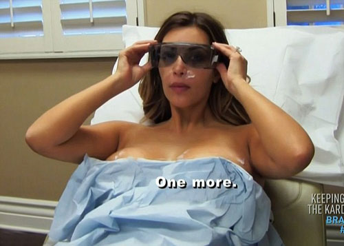 Quá trình trị rạn ngực bằng laser của Kim Kardashian
