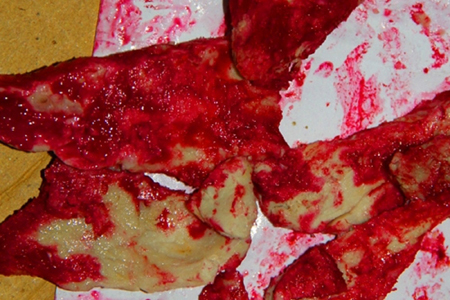 Thịt lợn luộc chín chuyển sang màu đỏ: Do nhiễm vi khuẩn gây bệnh