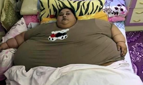 Người phụ nữ béo nhất thế giới, 25 năm không rời khỏi giường