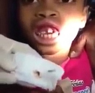 Phát hiện 15 con giòi trong khoang miệng bé 10 tuổi 