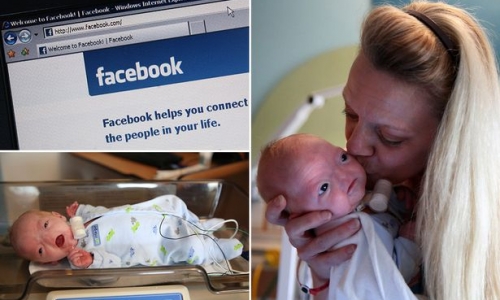 Facebook gây xôn xao dư luận vì gỡ ảnh bé trai không mũi 