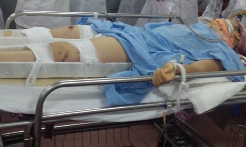 Hà Nội: Nữ sinh rơi từ tầng 3 xuống đất đã tử vong