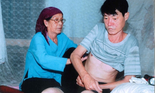 Quảng Ninh: Đánh người chấn thương 14%, chưa bị xử lý