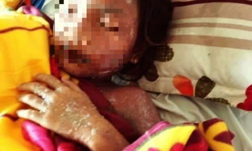 URC Việt Nam thu hồi nước Rồng Đỏ nơi bé gái bị nghi nhiễm độc mua uống?