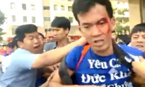 Côn đồ tấn công người dân khu chung cư cao cấp ở Sài Gòn