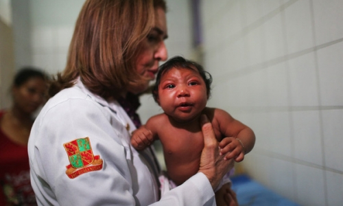 Trẻ không có dị tật đầu nhỏ cũng có thể bị nhiễm vi-rút Zika...