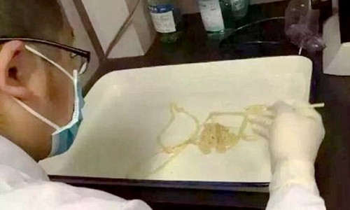 ‘Kinh hoàng’ phát hiện sán dây dài 5 mét trong ruột người