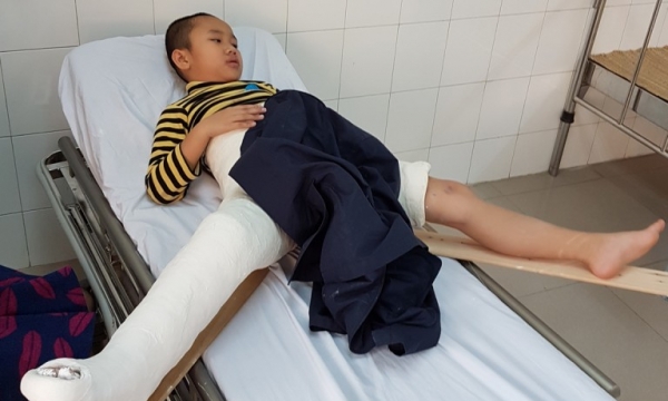 Vụ học sinh bị đâm gãy chân: Bộ GD&ĐT yêu cầu sớm xử lý, kết luận sự việc
