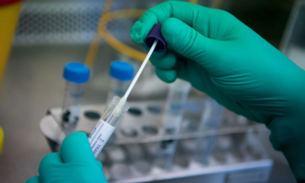Bác sĩ phát hiện virus SARS CoV-2 trong da của người âm tính ở Thụy Sĩ