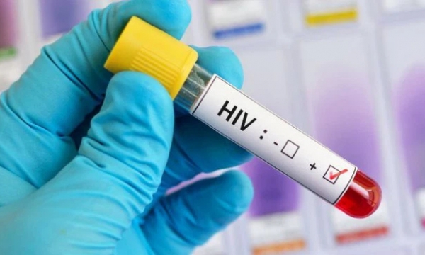Người nhiễm HIV tự khỏi, không cần sử dụng thuốc đặc trị