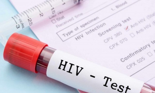 Xét nghiệm như thế nào để phát hiện người nhiễm HIV?