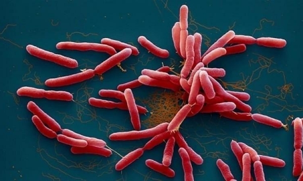 Phát hiện bệnh nhân mắc bệnh “vi khuẩn ăn thịt người” tại Thanh Hóa