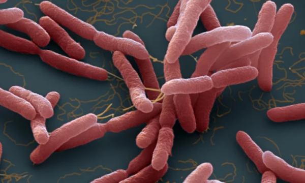 Cảnh giác với vi khuẩn 'ăn thịt người' gây bệnh Whitmore
