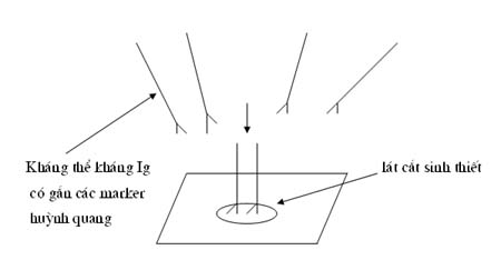 4. Quy Trình Thực Hiện Xét Nghiệm Miễn Dịch Huỳnh Quang