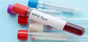 Những điều cần biết về  xét nghiệm hpv âm tính vẫn bị sùi mào gà 