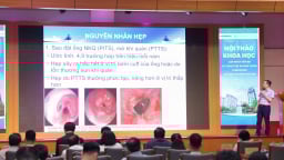 Đưa AI vào nội soi, bác sĩ chẩn đoán sớm ung thư phổi cùng nhiều bệnh lý hiếm gặp