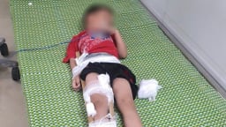 Ninh Bình: Bé trai 5 tuổi bị thương nặng vì ngã từ tầng 2 khách sạn