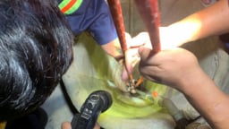 Cô gái bị rơi xuống giếng sâu được công an cứu nạn kịp thời