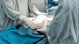 Tưởng đã hết tuổi mắc bệnh 'phần phụ', cụ bà 82 tuổi lên bàn mổ khẩn cấp 