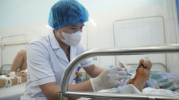 Mất nửa bàn chân vì cưa bình khí, bác sĩ cảnh báo nguy hiểm từ thiết bị thường gặp 