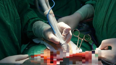 Bệnh viện đầu tiên tại miền Tây sử dụng hệ thống dao mổ siêu âm cắt gan cho bệnh nhân ung thư