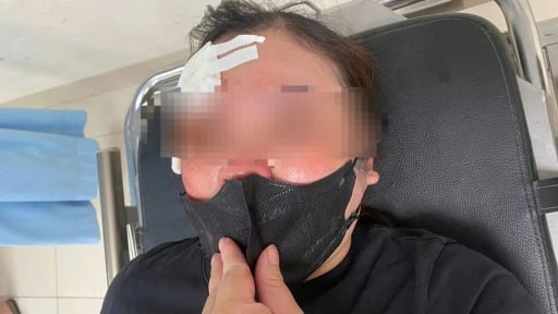 Nguyên nhân người phụ nữ bị đánh chảy máu đầu khi đang nghe điện thoại trên đường ở Hà Nội
