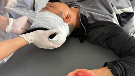 Quảng Ninh: Một người đàn ông bị đánh bằng điếu cày gục xuống đường
