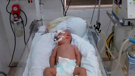 Cảnh báo trẻ mắc uốn ván do sinh tại nhà, tự cắt dây rốn
