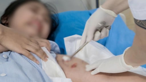 Bé 12 tuổi bị chó nhà hàng xóm cắn nhiều vết trên cơ thể 