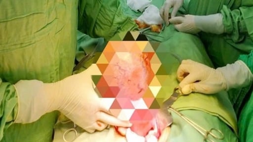 Bụng to như trống vì nghe lời quảng cáo uống thực phẩm chức năng 'teo u'