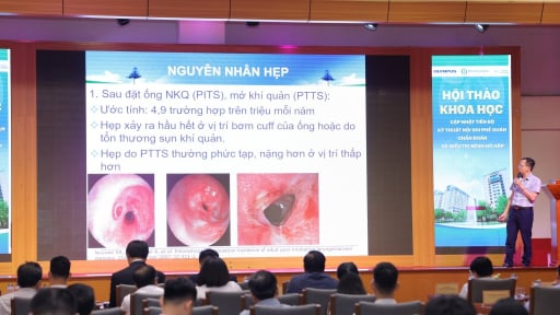 Đưa AI vào nội soi, bác sĩ chẩn đoán sớm ung thư phổi cùng nhiều bệnh lý hiếm gặp