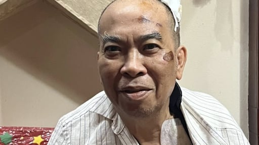 Thông tin mới nhất về sức khỏe của Chủ tịch Hội Nhà văn Việt Nam sau vụ tai nạn gãy xương