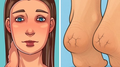 12 dấu hiệu bất ngờ cho thấy bạn không hợp với sữa