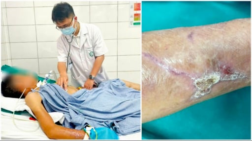 Co cứng toàn thân, suy hô hấp vì vết thương ngoài da 'tưởng nhẹ'