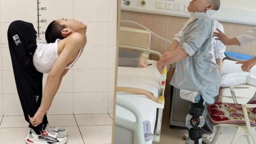 Bác sĩ quỳ gối để phẫu thuật cho nam sinh “gập người”, điều kỳ diệu đã xảy ra