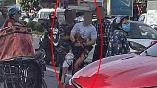 Vụ 'Tiktoker Hà List' bị chém lìa tay: Dấu hiệu của tội danh nào?