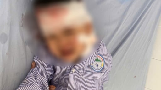 Cháu bé 3 tuổi ở Lào Cai bị chó cắn đứt tĩnh mạch hiện sức khoẻ ra sao?