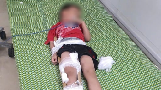 Ninh Bình: Bé trai 5 tuổi bị thương nặng vì ngã từ tầng 2 khách sạn