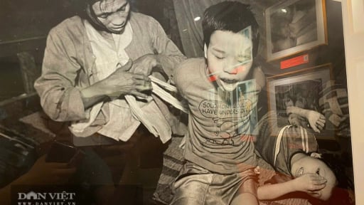Bảo tàng Chứng tích Chiến tranh: Những nỗi đau mang tên 'chất độc da cam' bóp nghẹt trái tim qua từng hiện vật